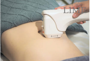 スタッフ1人で効率的な店舗運営! 『ハイフ専門店Lime』の収支モデルとサポート体制